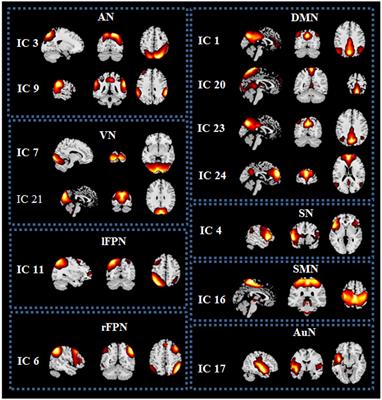 Increased functional connectivity between default mode network and <mark class="highlighted">visual network</mark> potentially correlates with duration of residual dizziness in patients with benign paroxysmal positional vertigo